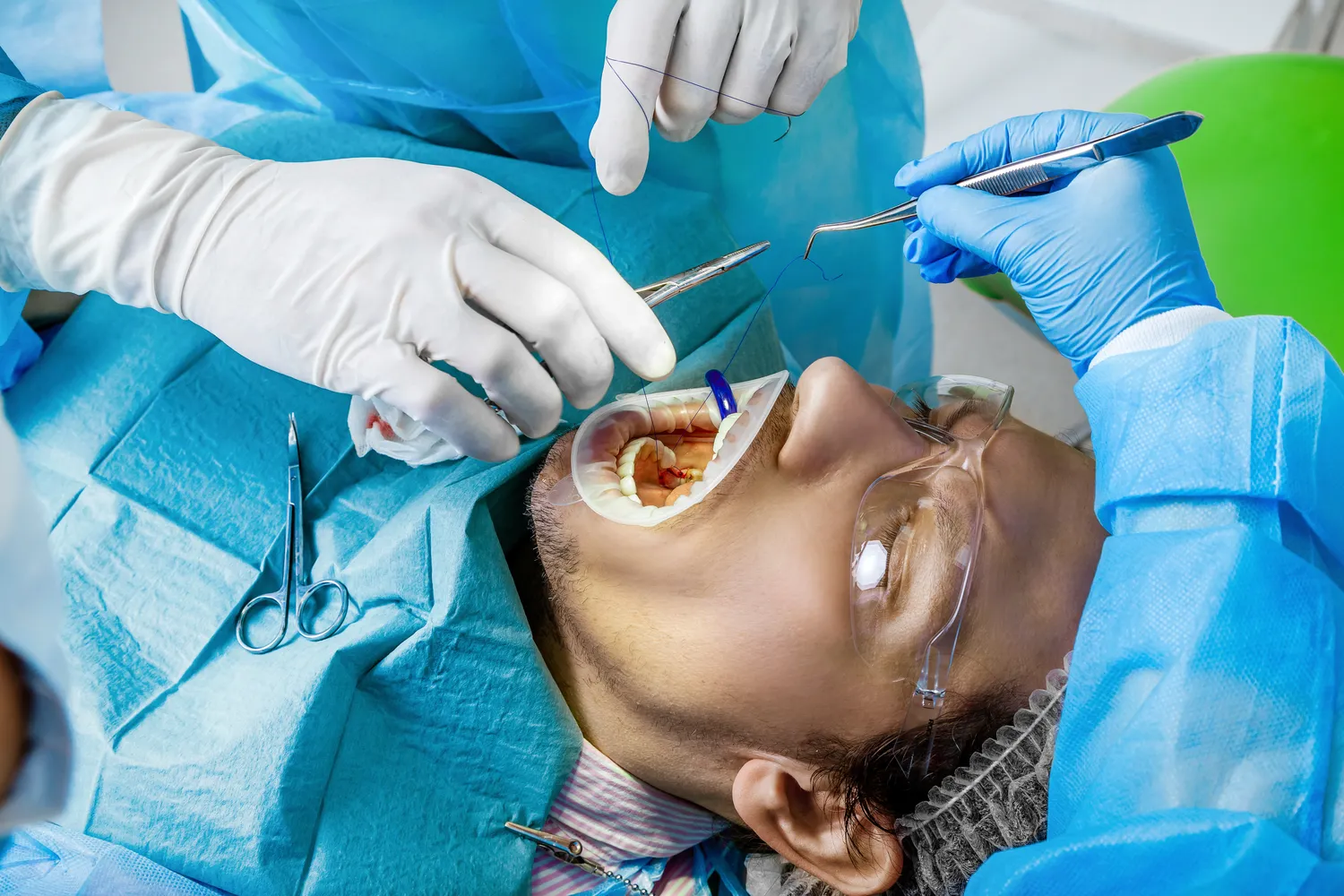 Implanty jak sie wstawia?