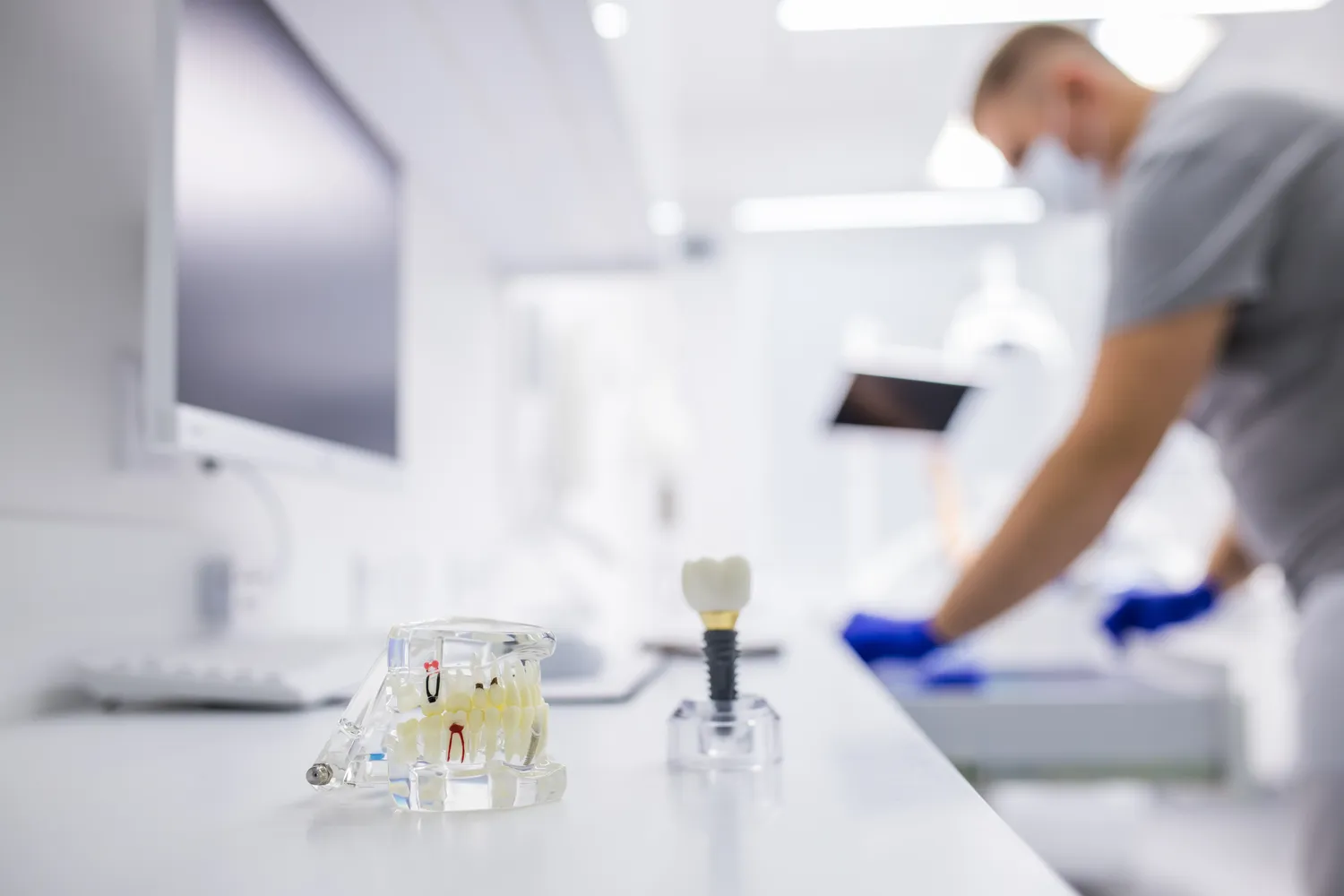 Ile kosztują implanty całej szczęki?