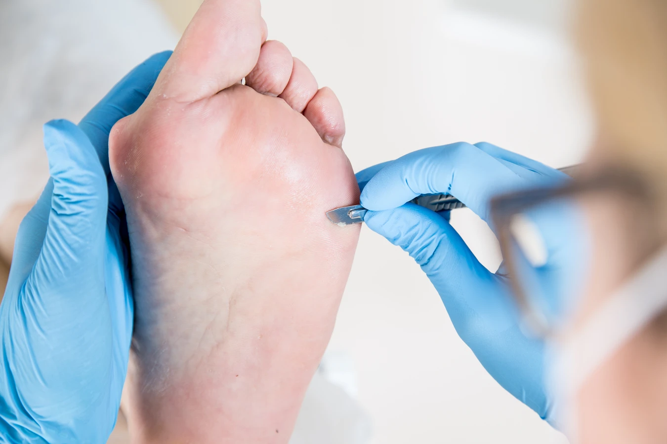  Kompleksowy przewodnik po podologii - co trzeba o niej wiedzieć?