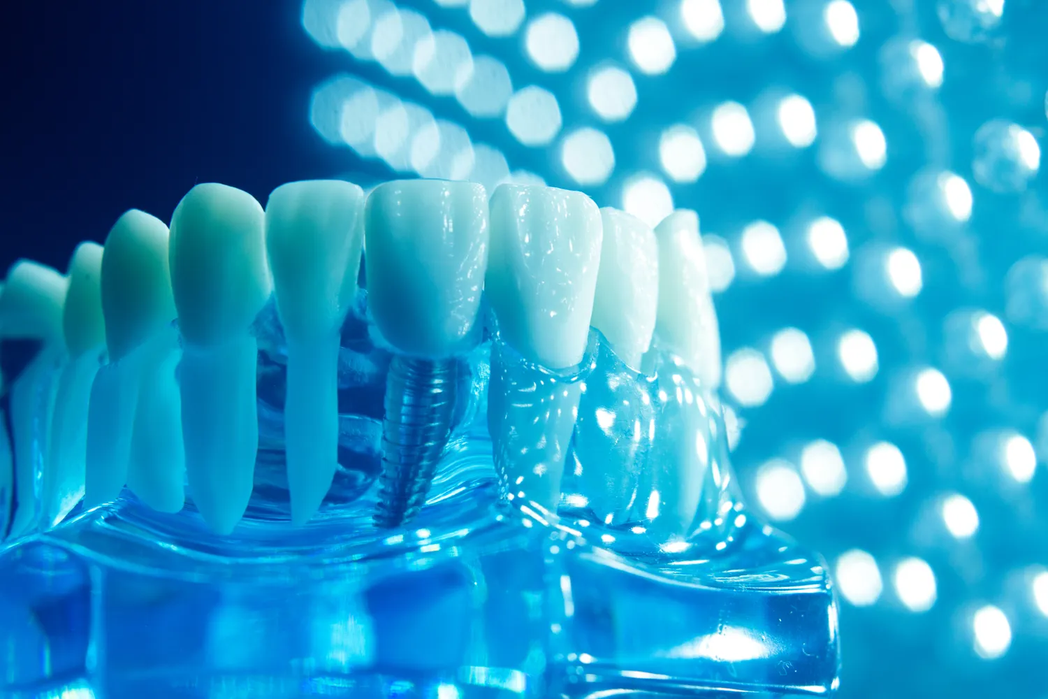 Leczenie stomatologiczne pod mikroskopem